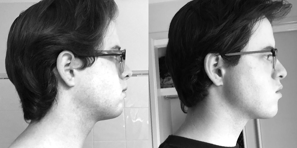 CHISELL FLAGSHIP JAW MUSCLE GROWTH TECHNOLOGY